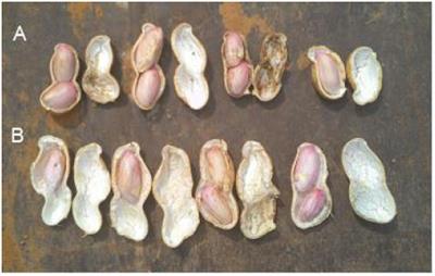 Transcriptome Analysis of Calcium- and Hormone-Related Gene Expressions during Different Stages of Peanut Pod Development